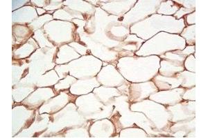 Rat visceral fat tissue was stained by Rabbit Anti-Adiponutrin (436-481) (Human) Serum (PNPLA3 anticorps  (AA 436-481))