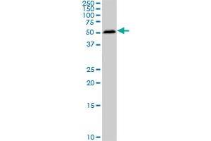 SMAD1 monoclonal antibody (M03), clone 2E9.