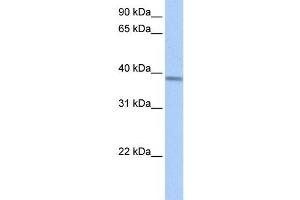 Western Blotting (WB) image for anti-Acyl-CoA Dehydrogenase, Short/branched Chain (ACADSB) antibody (ABIN2459779)