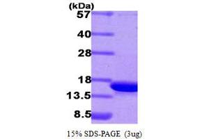 SDS-PAGE (SDS) image for Cyclin-Dependent Kinase 2 Associated Protein 1 (CDK2AP1) (AA 1-115) protein (His tag) (ABIN666944)