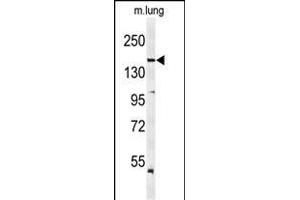 Western blot analysis of KDR  Antibody (ABIN652371 and ABIN2841771) in mouse lung tissue lysates (35 μg/lane). (VEGFR2/CD309 anticorps  (Tyr1175))