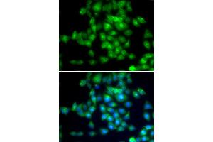 Immunofluorescence analysis of MCF-7 cells using SIRT3 antibody. (SIRT3 anticorps)