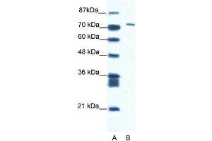 Human Jurkat; WB Suggested Anti-CXORF6 Antibody Titration: 1. (MAMLD1 anticorps  (N-Term))