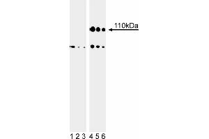Western blot analysis of Rb (pS807/pS811) in human embryonic skin cells. (Retinoblastoma 1 anticorps  (pSer807))