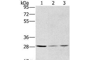 Western Blot analysis of A375, hela and A172 cell using HSD17B12 Polyclonal Antibody at dilution of 1:570 (HSD17B12 anticorps)