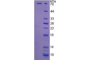 SDS-PAGE analysis of Human CAPN5 Protein.