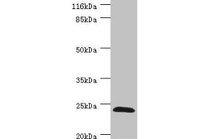 Western blot All lanes: GSTZ1 antibody at 0. (GSTZ1 anticorps  (AA 1-216))