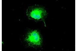 Anti-CTAG1B mouse monoclonal antibody (ABIN2452329) immunofluorescent staining of COS7 cells transiently transfected by pCMV6-ENTRY CTAG1B (RC213318). (CTAG1B anticorps)