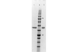 SDS-PAGE results of ERK2 Recombinant Protein.