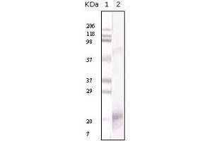 Western Blotting (WB) image for anti-Interferon gamma (IFNG) antibody (ABIN2464066) (Interferon gamma anticorps)