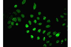 Immunofluorescent analysis of A549 cells using ABIN7150189 at dilution of 1:100 and Alexa Fluor 488-congugated AffiniPure Goat Anti-Rabbit IgG(H+L)