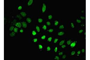 Immunofluorescent analysis of A549 cells using ABIN7150189 at dilution of 1:100 and Alexa Fluor 488-congugated AffiniPure Goat Anti-Rabbit IgG(H+L) (LIG1 anticorps  (AA 1-919))
