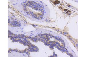 Paraformaldehyde-fixed, paraffin embedded mouse prostate, Antigen retrieval by boiling in sodium citrate buffer (pH6) for 15min, Block endogenous peroxidase by 3% hydrogen peroxide for 30 minutes, Blocking buffer at 37°C for 20min, Antibody incubation with Cytokeratin 14 (2F11) Monoclonal Antibody  at 1:50 overnight at 4°C, followed by a conjugated secondary and DAB staining.