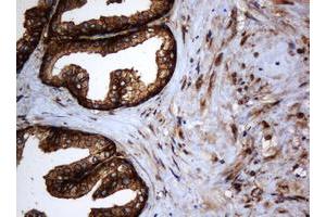 Image no. 3 for anti-SERPINE1 mRNA Binding Protein 1 (SERBP1) (AA 1-262) antibody (ABIN1490674)