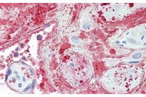Detection of TPOR in Human Placenta Tissue using Polyclonal Antibody to Thrombopoietin Receptor (TPOR) (MPL anticorps  (AA 66-260))