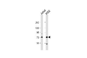 All lanes : Anti-PRMT5 Antibody (N-term) at 1:1000 dilution Lane 1: Jurkat whole cell lysate Lane 2: K562 whole cell lysate Lysates/proteins at 20 μg per lane. (PRMT5 anticorps  (N-Term))