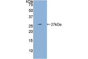 Western blot analysis of recombinant Human PSG1. (PSG1 anticorps  (AA 202-401))