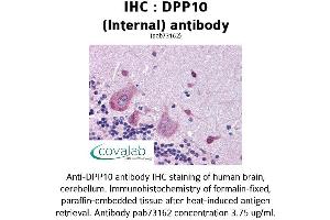 Image no. 1 for anti-Dipeptidylpeptidase 10 (DPP10) (Internal Region) antibody (ABIN1733745) (DPP10 anticorps  (Internal Region))