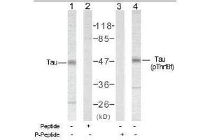 Image no. 1 for anti-Microtubule-Associated Protein tau (MAPT) (Thr181) antibody (ABIN197263) (MAPT anticorps  (Thr181))