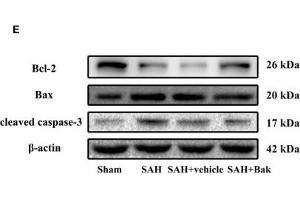 The effects of Bak on cellular apoptosis and neuronal degeneration following SAH. (beta Actin anticorps  (AA 1-375))