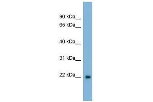 LBX2 antibody used at 0. (LBX2 anticorps  (Middle Region))