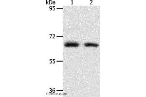 Western blot analysis of Human fetal kidney and fetal lung tissue, using ACOT11 Polyclonal Antibody at dilution of 1:450
