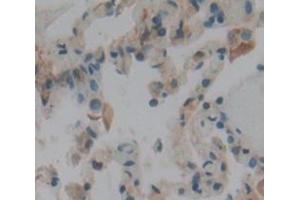 IHC-P analysis of Human Tissue, with DAB staining. (Calmodulin 1 anticorps  (AA 1-149))