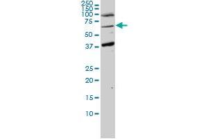 Western Blotting (WB) image for anti-Alveolar Soft Part Sarcoma Chromosome Region, Candidate 1 (ASPSCR1) (AA 1-554) antibody (ABIN466238) (ASPSCR1 anticorps  (AA 1-554))
