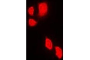 Immunofluorescent analysis of JAK2 staining in Jurkat cells. (JAK2 anticorps)
