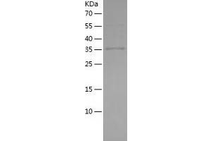 Western Blotting (WB) image for Mannose Receptor, C Type 1 (MRC1) (AA 19-148) protein (His-IF2DI Tag) (ABIN7123842)