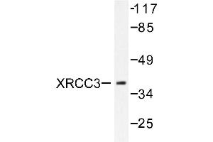Image no. 2 for anti-X-Ray Repair Complementing Defective Repair in Chinese Hamster Cells 3 (XRCC3) antibody (ABIN271981) (XRCC3 anticorps)