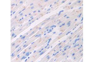 Used in DAB staining on fromalin fixed paraffin- embedded heart tissue (FLRT2 anticorps  (AA 300-517))