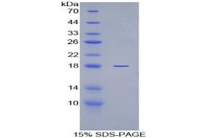 SDS-PAGE of Protein Standard from the Kit (Highly purified E.