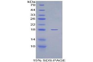 SDS-PAGE of Protein Standard from the Kit (Highly purified E. (IL-6 Receptor Kit ELISA)