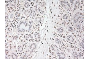 Immunohistochemical staining of paraffin-embedded breast tissue using anti-USP13 mouse monoclonal antibody. (USP13 anticorps)