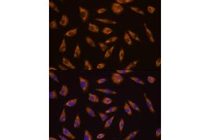 anti-Glucagon-Like Peptide 1 Receptor (GLP1R) (AA 22-116) antibody