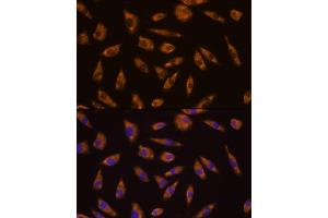 Immunofluorescence analysis of L929 cells using GLP1R antibody (ABIN6131006, ABIN6141138, ABIN6141140 and ABIN6224643) at dilution of 1:100. (GLP1R anticorps  (AA 22-116))