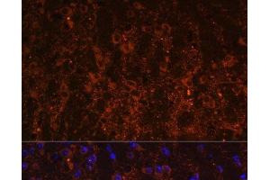 Immunofluorescence analysis of Mouse brain using SNX13 Polyclonal Antibody at dilution of 1:100. (SNX13 anticorps)