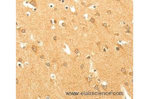 Immunohistochemistry of Human brain  using AARS2 Polyclonal Antibody at dilution of 1:40 (AARS2 anticorps)