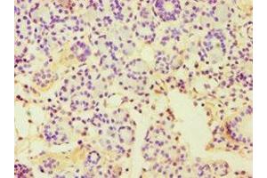 Immunohistochemistry of paraffin-embedded human pancreatic tissue using ABIN7150999 at dilution of 1:100 (CBLC anticorps  (AA 245-474))