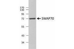 Western Blotting (WB) image for anti-SWAP Switching B-Cell Complex 70kDa Subunit (SWAP70) antibody (ABIN2666297) (SWAP70 anticorps)