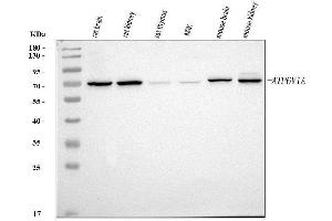 Western blot analysis of ATP6V1A using anti-ATP6V1A antibody (ABIN7599916).