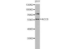 Western blot analysis of extracts of 293T cells, using ACCS antibody (ABIN6293455) at 1:1000 dilution. (PHACS anticorps)