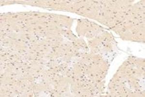Immunohistochemistry analysis of paraffin-embedded mouse heart using,MCC-2 (ABIN7076163) at dilution of 1: 6000 (USHBP1 anticorps)