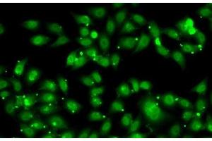 Immunofluorescence analysis of MCF7 cells using NR2C1 Polyclonal Antibody