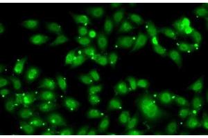 Immunofluorescence analysis of MCF7 cells using NR2C1 Polyclonal Antibody (NR2C1 anticorps)