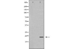 Western blot analysis of extracts of mouse kidney tissue , using REG3G antibody.