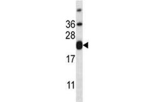 CD3e antibody western blot analysis in HL-60 lysate