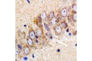 Immunohistochemical analysis of IGF2BP3 staining in mouse brain formalin fixed paraffin embedded tissue section. (IGF2BP3 anticorps)