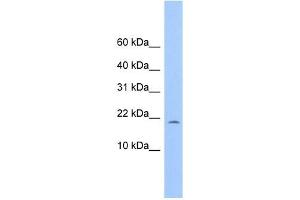 C10ORF83 antibody used at 1 ug/ml to detect target protein. (MORN4 anticorps  (Middle Region))